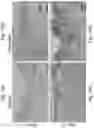 Fig. 11 - Soy-derived bioactive peptides for use in compositions and methods for wound healing, tissue engineering, and regenerative medicine