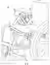 Fig. 05 - Methods and devices for portable sterilization and containment of medical devices