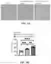 Fig. 11 - Decellularized extracellular matrix, preparation process and uses thereof