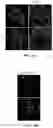 Fig. 13 - Decellularized extracellular matrix, preparation process and uses thereof