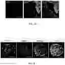 Fig. 16 - Decellularized extracellular matrix, preparation process and uses thereof
