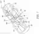 Fig. 08 - Combined respiratory muscle training and oscillating positive expiratory pressure device