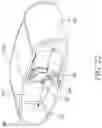 Fig. 18 - Combined respiratory muscle training and oscillating positive expiratory pressure device