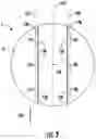 Fig. 04 - Dual laser closure scan and method of using the same