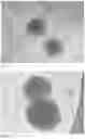 Fig. 02 - Transplantable cell composition comprising eukaryotic cells in a nanofibrillar cellulose hydrogel, method for preparing thereof and use of nanofibrillar cellulose