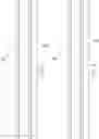 Fig. 04 - DRINKING STRAW ASSEMBLY AND RELATED METHODS