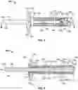 Fig. 06 - Rivet fastener assembly and method of use thereof