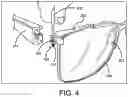 Fig. 05 - Screw with integrated slot