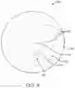 Fig. 07 - Stick on devices using peripheral defocus to treat progressive refractive error