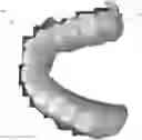 Fig. 01 - Teeth segmentation using neural networks