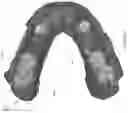 Fig. 35 - Teeth segmentation using neural networks