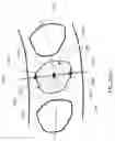 Fig. 41 - Teeth segmentation using neural networks