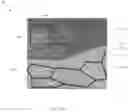 Fig. 43 - Teeth segmentation using neural networks