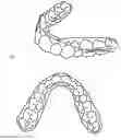 Fig. 09 - METHOD FOR ANALYZING AN IMAGE OF A DENTAL ARCH