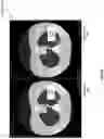 Fig. 26 - Generating lesion change prediction data for medical scans