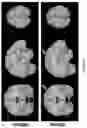 Fig. 49 - Systems and methods for fusing EEG and fMRI through hierarchical deep transcoding