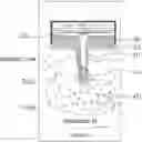 Fig. 01 - NEEDLE-TYPE BIOSENSOR