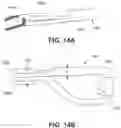 Fig. 22 - Variable denier yarn and suture