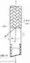 Fig. 25 - Variable denier yarn and suture