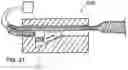 Fig. 31 - Variable denier yarn and suture