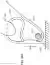 Fig. 32 - Variable denier yarn and suture