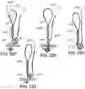 Fig. 38 - Variable denier yarn and suture