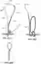 Fig. 39 - Variable denier yarn and suture