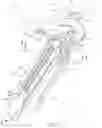 Fig. 03 - Staple cartridge comprising cartridge body and attached support