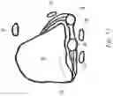 Fig. 09 - Opening and closing wedge osteotomy guide and method