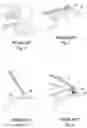 Fig. 02 - Bipolar coagulating devices and vasectomy kits associated therewith