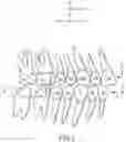 Fig. 04 - SINGLE ARCH MANDIBULAR ADVANCER