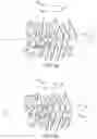 Fig. 05 - SINGLE ARCH MANDIBULAR ADVANCER