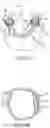 Fig. 09 - SINGLE ARCH MANDIBULAR ADVANCER