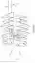 Fig. 11 - SINGLE ARCH MANDIBULAR ADVANCER