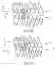 Fig. 12 - SINGLE ARCH MANDIBULAR ADVANCER