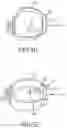 Fig. 13 - SINGLE ARCH MANDIBULAR ADVANCER