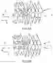Fig. 14 - SINGLE ARCH MANDIBULAR ADVANCER