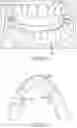 Fig. 18 - SINGLE ARCH MANDIBULAR ADVANCER