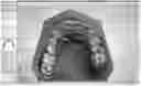 Fig. 01 - Method for aligning digital representations of a patient's jaws