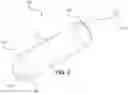 Fig. 02 - TUBULAR TAMPON AND METHOD OF MANUFACTURING SAME