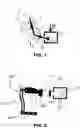 Fig. 02 - LOAD COMPENSATION DEVICE, IN PARTICULAR OF GRAVITATIONAL LOADS, APPLICABLE TO EXOSKELETONS