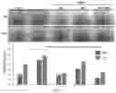 Fig. 03 - Composition using 4′,6,7-trimethoxyisoflavone and catechol for managing pulmonary fibrosis