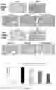 Fig. 08 - Composition using 4′,6,7-trimethoxyisoflavone and catechol for managing pulmonary fibrosis