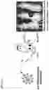 Fig. 09 - Methods and Compositions for Two-Stage Microbubble Delivery of Active Agents