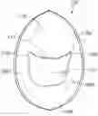 Fig. 01 - Biological valve for venous insufficiency