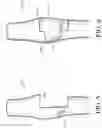 Fig. 07 - Biological valve for venous insufficiency