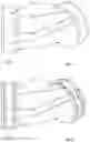 Fig. 04 - AN EXTRUSION AND/OR PULTRUSION DEVICE AND METHOD