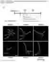 Fig. 15 - A GENETICALLY ENCODED PROTEIN SYNTHESIS INHIBITOR