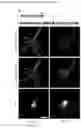 Fig. 22 - A GENETICALLY ENCODED PROTEIN SYNTHESIS INHIBITOR