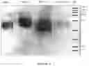 Fig. 10 - Modified human erythropoietin